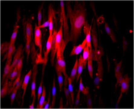 Anti-CD73 Antibody, clone AA60-E3-3, Cy3 Conjugate clone AA60-E3-3, from mouse, CY3 conjugate