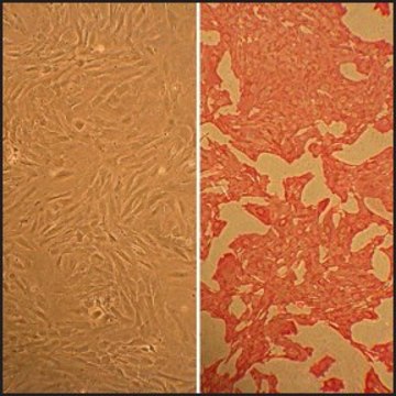 Rat Aortic Smooth Muscle Cells: RAOSMC, adult