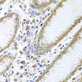 Anti-EIF4E antibody produced in rabbit