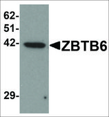 Anti-ZBTB6 antibody produced in rabbit affinity isolated antibody, buffered aqueous solution