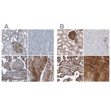 Anti-PLEC antibody produced in rabbit Prestige Antibodies&#174; Powered by Atlas Antibodies, affinity isolated antibody, buffered aqueous glycerol solution, ab2