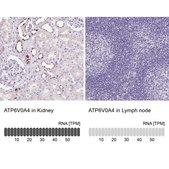 Anti-ATP6V0A4 antibody produced in rabbit Prestige Antibodies® Powered by Atlas Antibodies, affinity isolated antibody, buffered aqueous glycerol solution