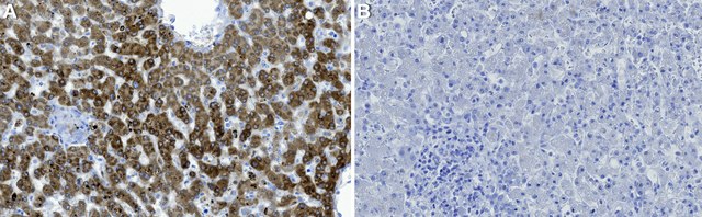 Anti-SOCS-3 Antibody, clone 2N6 ZooMAb&#174; Rabbit Monoclonal recombinant, expressed in HEK 293 cells