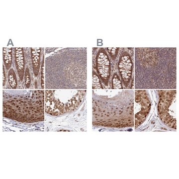 Anti-WAPL antibody produced in rabbit Prestige Antibodies&#174; Powered by Atlas Antibodies, affinity isolated antibody, buffered aqueous glycerol solution