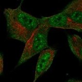 Anti-PNISR antibody produced in rabbit Prestige Antibodies® Powered by Atlas Antibodies, affinity isolated antibody, buffered aqueous glycerol solution