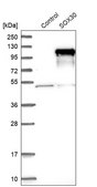 Anti-SOX30 antibody produced in rabbit Prestige Antibodies® Powered by Atlas Antibodies, affinity isolated antibody, buffered aqueous glycerol solution