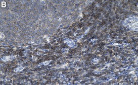 Anti-SIPA1 Antibody, clone 1D5 ZooMAb® Rabbit Monoclonal recombinant, expressed in HEK 293 cells