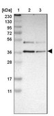 Anti-GALE antibody produced in rabbit Prestige Antibodies® Powered by Atlas Antibodies, affinity isolated antibody, buffered aqueous glycerol solution