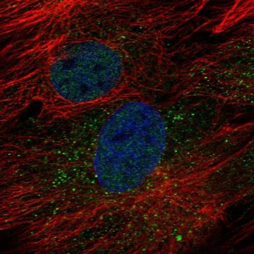 Anti-GOLT1B antibody produced in rabbit Prestige Antibodies&#174; Powered by Atlas Antibodies, affinity isolated antibody