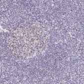 Anti-CENPH antibody produced in rabbit Prestige Antibodies® Powered by Atlas Antibodies, affinity isolated antibody, buffered aqueous glycerol solution