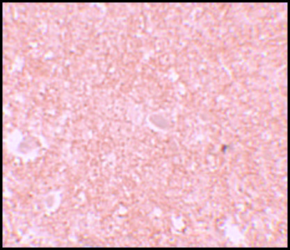 Anti-NALP10 antibody produced in rabbit affinity isolated antibody, buffered aqueous solution