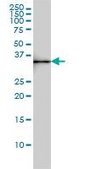 Monoclonal Anti-SDSL antibody produced in mouse clone M2, purified immunoglobulin, buffered aqueous solution