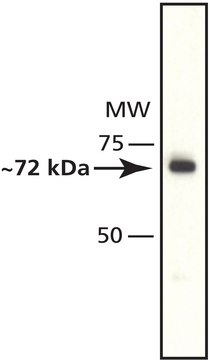 Anti-Histone Deacetylase 10 (HDAC10) antibody produced in rabbit affinity isolated antibody, buffered aqueous solution