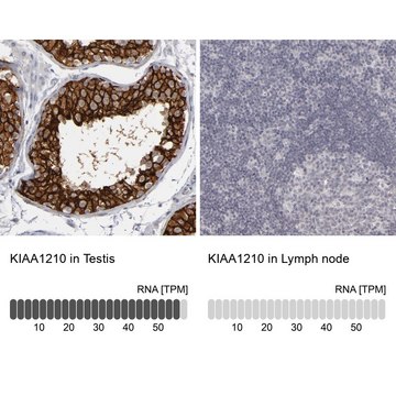 Anti-KIAA1210 antibody produced in rabbit Prestige Antibodies&#174; Powered by Atlas Antibodies, affinity isolated antibody, buffered aqueous glycerol solution