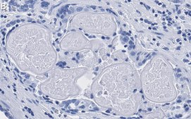 Anti-Phospho-HDAC7-(Ser486) Antibody, clone 3O11 ZooMAb® Rabbit Monoclonal recombinant, expressed in HEK 293 cells