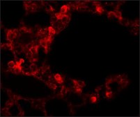 Anti-ESRP2 antibody produced in rabbit affinity isolated antibody