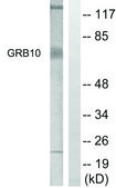 Anti-GRB10 antibody produced in rabbit affinity isolated antibody
