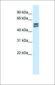 Anti-G6PD antibody produced in rabbit affinity isolated antibody