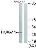 Anti-HOXA11 antibody produced in rabbit affinity isolated antibody