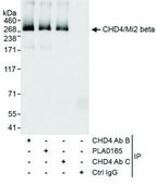 Rabbit anti-CHD4/Mi2 beta Antibody, Affinity Purified Powered by Bethyl Laboratories, Inc.