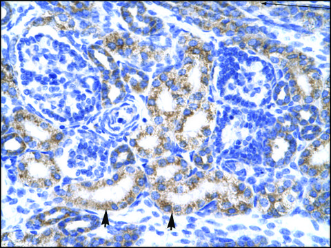 Anti-CREB3L2 antibody produced in rabbit IgG fraction of antiserum