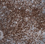 Monoclonal Anti-CD5 antibody produced in mouse Prestige Antibodies® Powered by Atlas Antibodies, clone CL12420, purified immunoglobulin, buffered aqueous glycerol solution