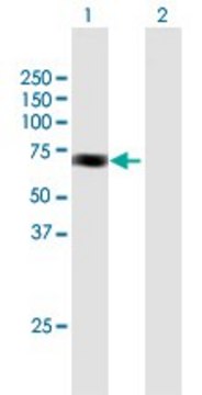 Anti-ACAD9 antibody produced in mouse IgG fraction of antiserum, buffered aqueous solution