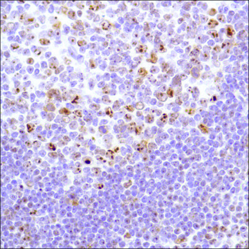 Anti-Nucleophosmin antibody, Rabbit monoclonal clone SP236, recombinant, expressed in proprietary host, affinity isolated antibody