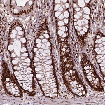 抗-ANP32A 兔抗 Prestige Antibodies&#174; Powered by Atlas Antibodies, affinity isolated antibody, buffered aqueous glycerol solution