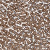 Anti-CC2D1A antibody produced in rabbit Prestige Antibodies® Powered by Atlas Antibodies, affinity isolated antibody, buffered aqueous glycerol solution