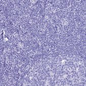 抗-PATE4 兔抗 Prestige Antibodies® Powered by Atlas Antibodies, affinity isolated antibody, buffered aqueous glycerol solution