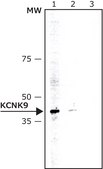 Anti-KCNK9 (TASK-3) antibody, Mouse monoclonal clone KCN-75, purified from hybridoma cell culture