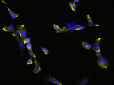 SK-MEL-147 Human Melanoma Cell Line&nbsp;