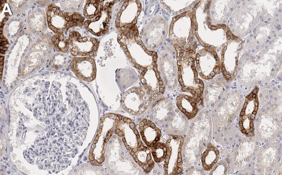 Anti-Raf-1 Antibody, clone 1I3 ZooMAb&#174; Rabbit Monoclonal recombinant, expressed in HEK 293 cells