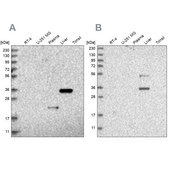 Anti-RGN antibody produced in rabbit Prestige Antibodies® Powered by Atlas Antibodies, affinity isolated antibody, buffered aqueous glycerol solution, ab2