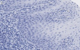 Anti-FAM49A Antibody, clone 2D6 ZooMAb® Rabbit Monoclonal recombinant, expressed in HEK 293 cells