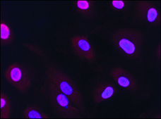 Anti-HMGB1 (HMG1) (N-terminal) antibody produced in rabbit affinity isolated antibody, buffered aqueous solution