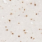 抗-RBM39 兔抗 Prestige Antibodies® Powered by Atlas Antibodies, affinity isolated antibody, buffered aqueous glycerol solution