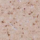 Anti-SEZ6L2 antibody produced in rabbit Prestige Antibodies® Powered by Atlas Antibodies, affinity isolated antibody, buffered aqueous glycerol solution