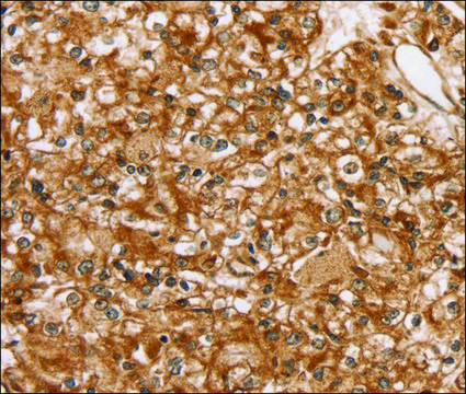 Anti-SLC16A8 antibody produced in rabbit affinity isolated antibody