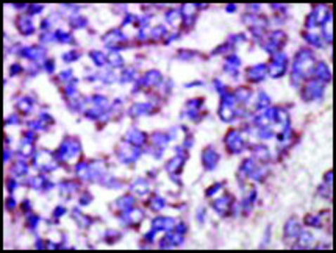 Anti-LATS1 (N-term) antibody produced in rabbit IgG fraction of antiserum, buffered aqueous solution