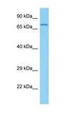 Anti-GP1BA antibody produced in rabbit affinity isolated antibody