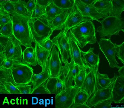 MEC1 Mouse Embryonic Epicardial Cell Line MEC1 mouse embryonic epicardial cell line is a useful model for cardiac developmental biology studies.