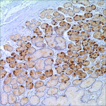 Gastrin Rabbit Polyclonal Antibody