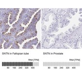 Anti-SNTN antibody produced in rabbit Prestige Antibodies® Powered by Atlas Antibodies, affinity isolated antibody, buffered aqueous glycerol solution