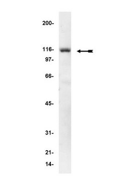 抗-&#945;-Actinin抗体，克隆AT6/172 clone AT6/172, Upstate&#174;, from mouse