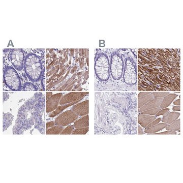 Anti-SRL antibody produced in rabbit Prestige Antibodies&#174; Powered by Atlas Antibodies, affinity isolated antibody, buffered aqueous glycerol solution