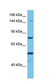 Anti-TMEM2 antibody produced in rabbit affinity isolated antibody