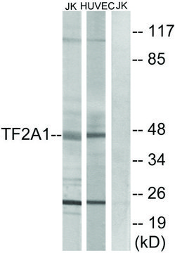 Anti-TF2A1 antibody produced in rabbit affinity isolated antibody