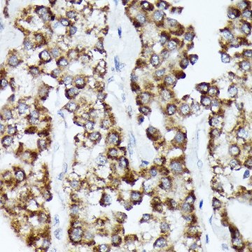 Anti-CDCA3 antibody produced in rabbit